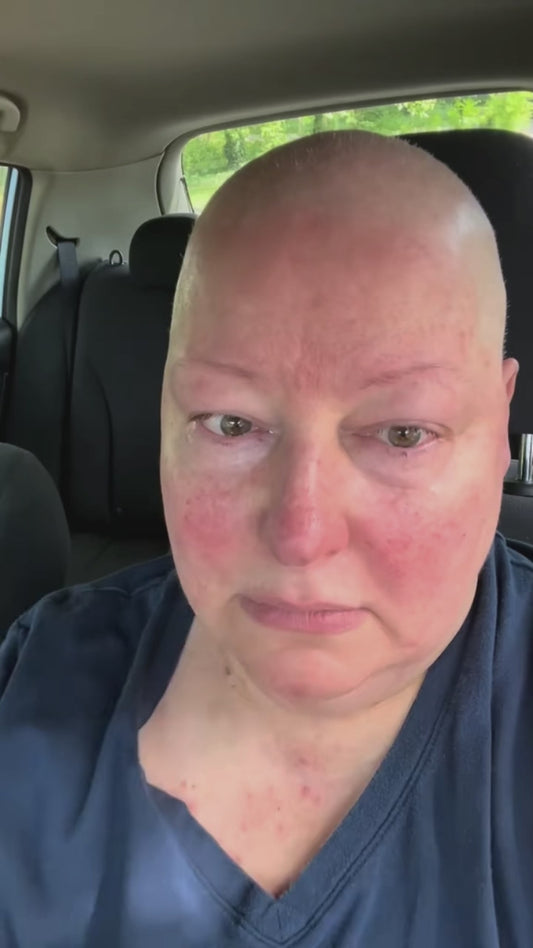 Laura Has Stage Two Cancer. She Can't Stop Crying. And She's Facing It All Alone.